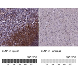 BLNK Antibody, Novus Biologicals:Antibodies:Primary Antibodies